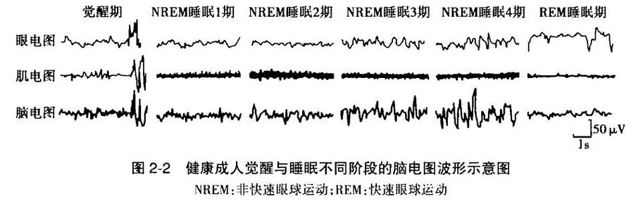 nrem医学上是什么意思