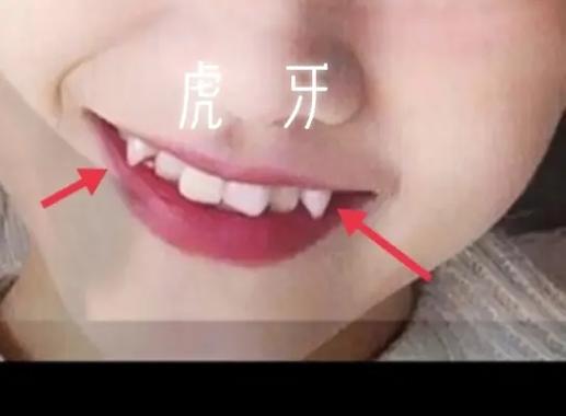 虎牙特殊符号名字
