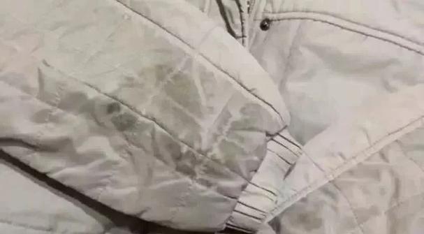 羽绒服上的黄斑怎么去除小窍门