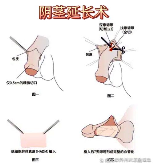 男性又短又小怎么改善方法