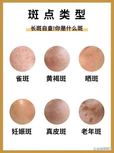 美白淡斑精华使用步骤