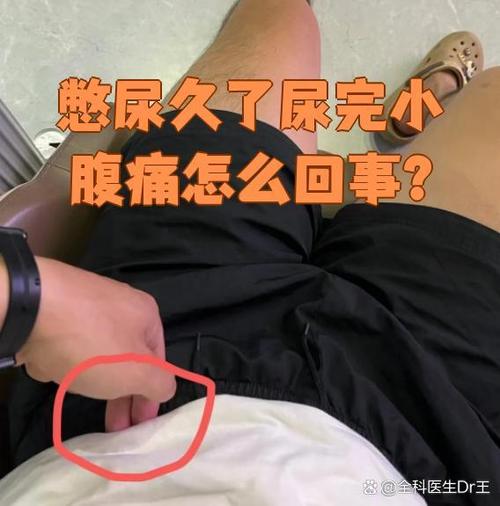 小便不顺畅有种堵着的感觉截图