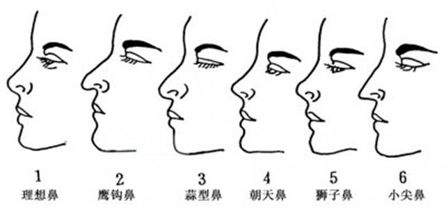 膨体隆鼻老了会怎样