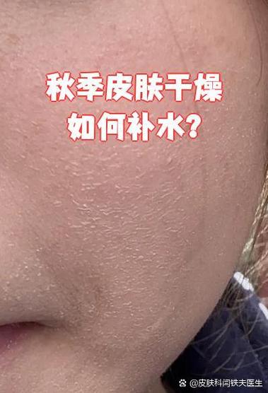 秋季皮肤干燥