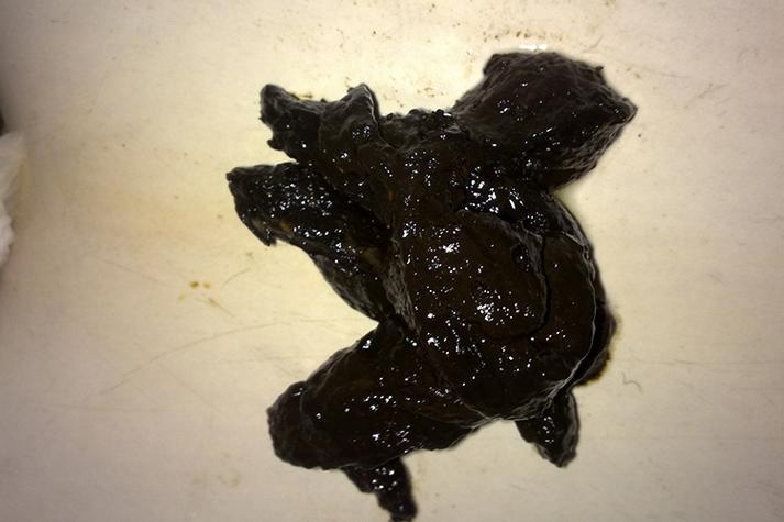 肚子胀气拉屎是黑的