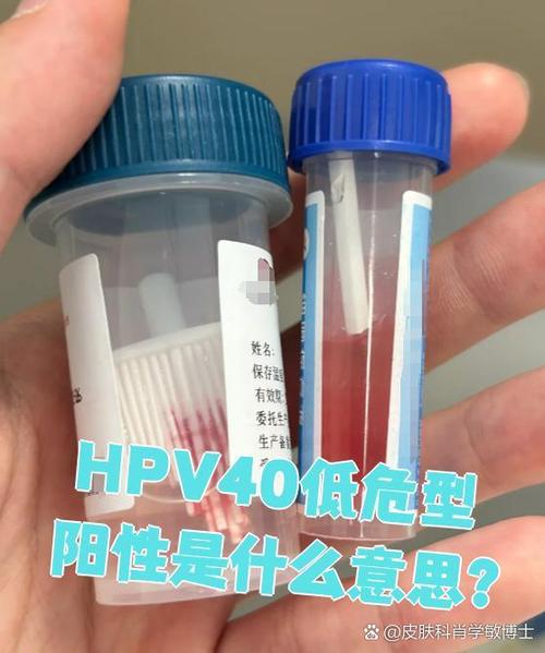 hpv低危40型阳性是什么意思