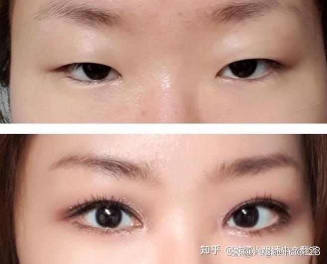 双眼皮好看还是单眼皮好看