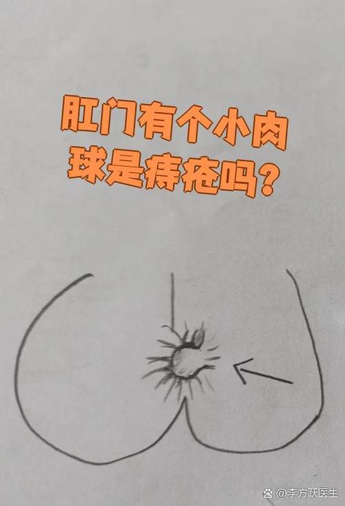 肛门口长个肉疙瘩是什么原因