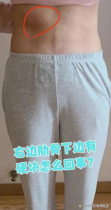 右胁骨边缘下有一硬块