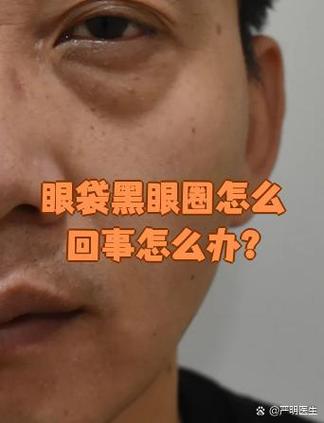 仓眼里有黑怎么办