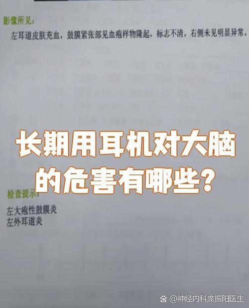 耳机对大脑有没有伤害
