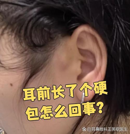 耳朵硬是怎么回事