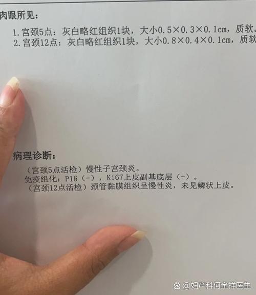 cinii是什么意思