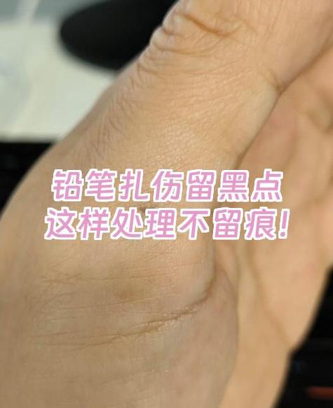 去除铅笔印最有效的方法