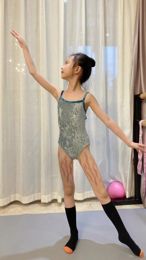 我的舞蹈57集全免费看