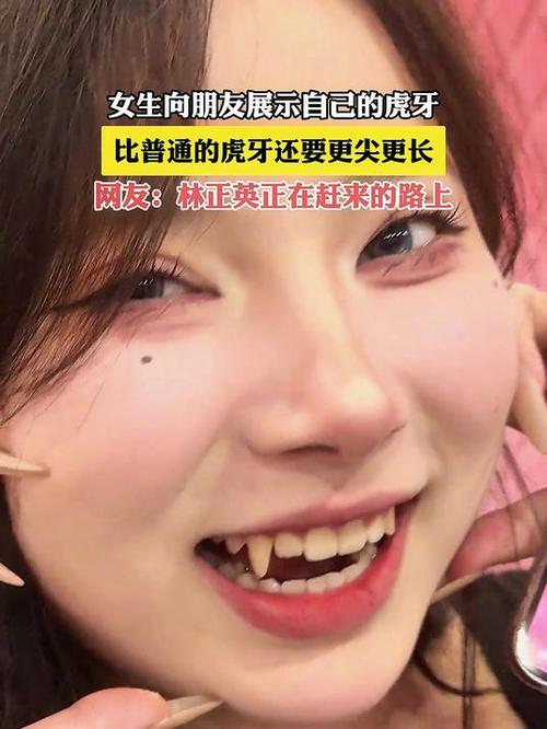 老版本虎牙tv缩略图