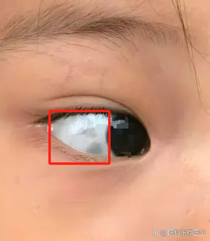 只有眼白的眼睛图片缩略图