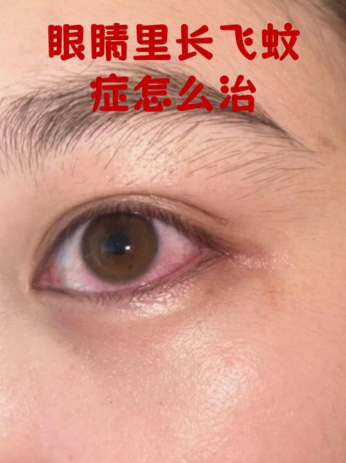 水飞点眼