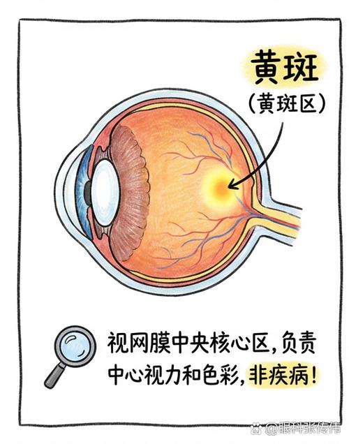 屏幕上黄斑能修复吗
