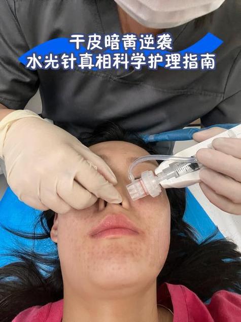 50岁打水光针有效果吗