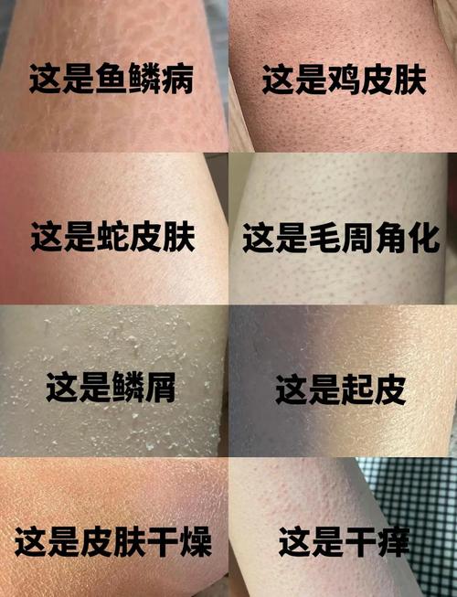 美丽鳞片可以直接使用吗