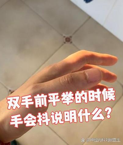 正常人两手平举会抖吗截图