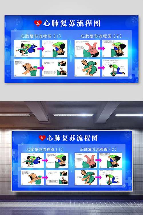心脏复苏的正确步骤