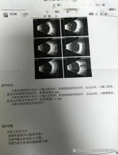 拍照灯光闪烁是什么原因游戏截图