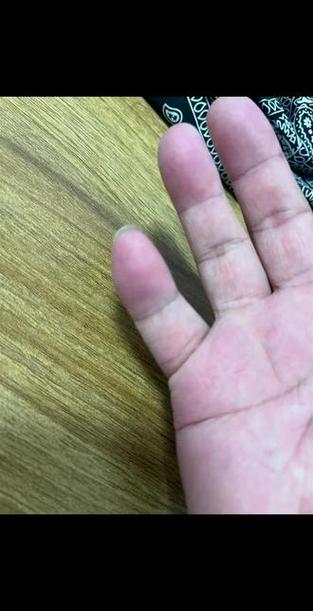 小拇指两节有什么说法