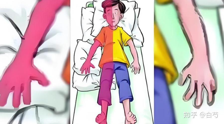 格林巴利综合征的临床表现缩略图
