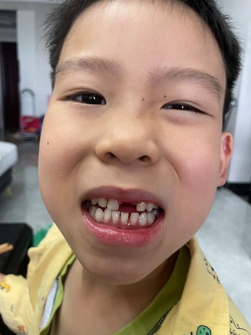 缺颗牙的表情包