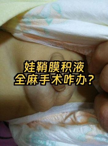 全麻多久可以备孕要孩子