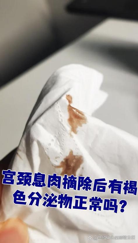 息肉做了2个月后又出现褐色