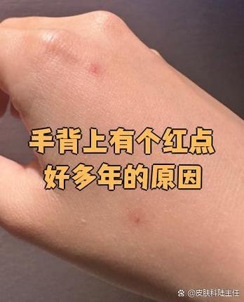 iwatch上有个红点