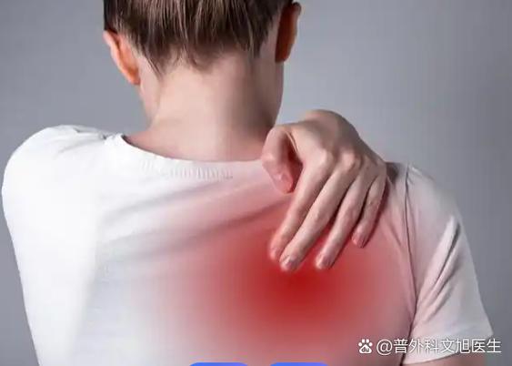怎么判断后背疼是不是肿瘤