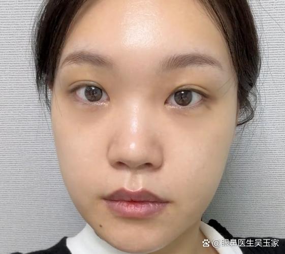 每天拍脸多久会有效果