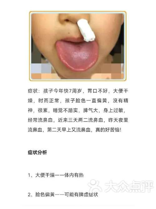 孩子鼻子流鼻血怎么办
