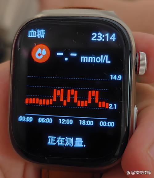 血糖手表建议买吗