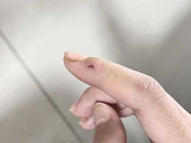 仓鼠咬我给我弄死了