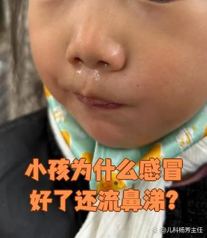 小孩流鼻涕图片搞笑