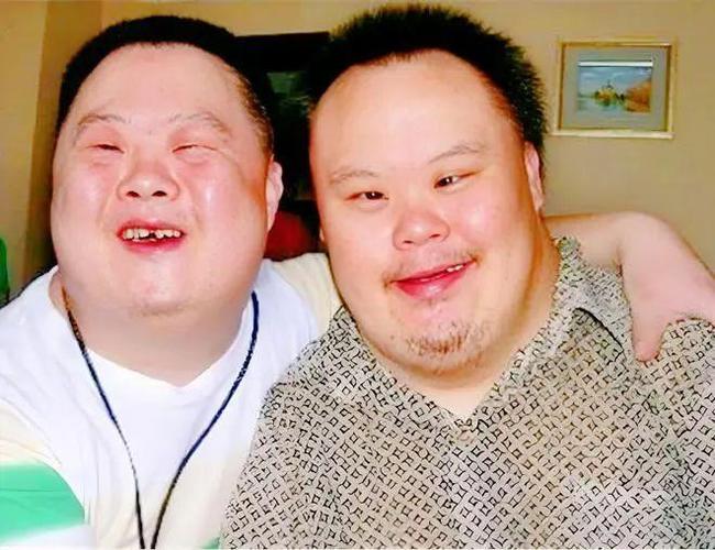 唐宝宝智力有正常的吗