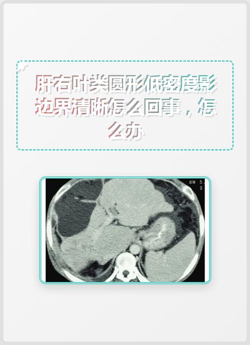 影棚拍摄如何消除影子