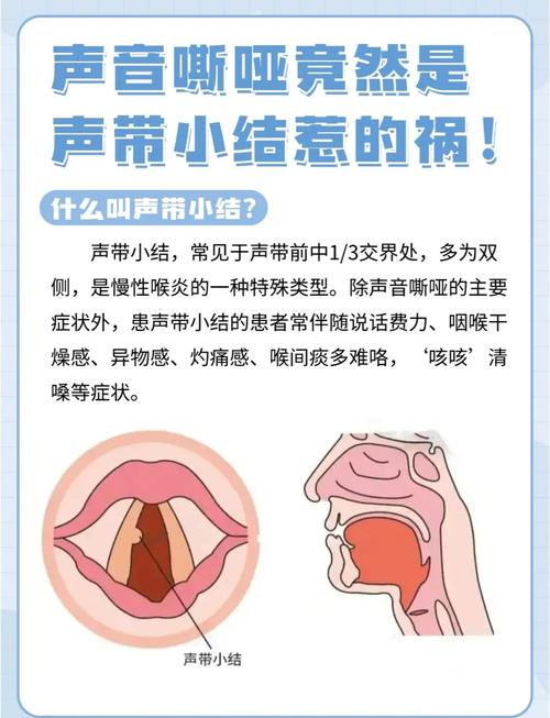 小孩声带小结可以自愈吗