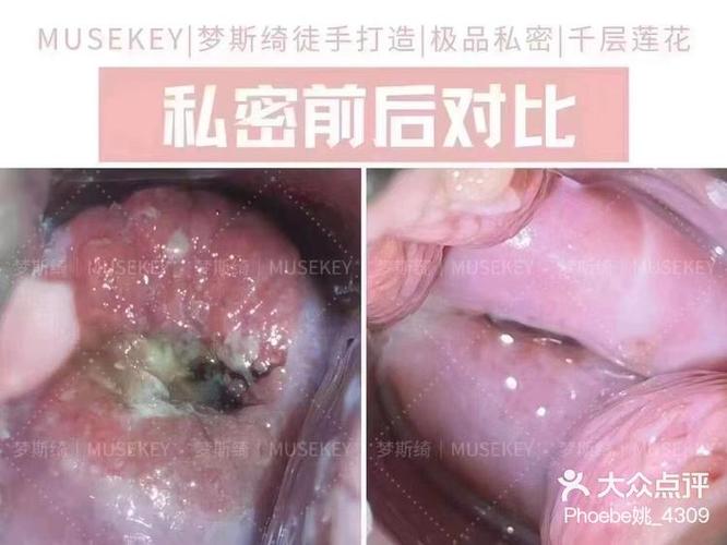 视频设为私密怎么打开