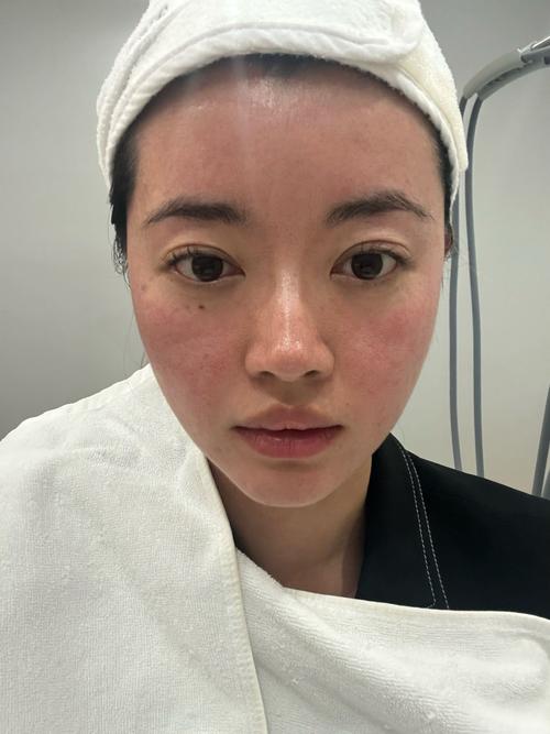 人脸上有绿光如何去除