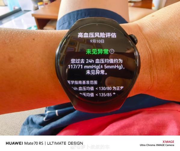 watch5怎么测血压