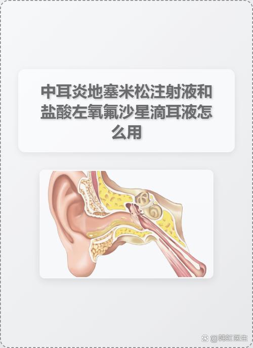 中耳炎治疗最佳方法