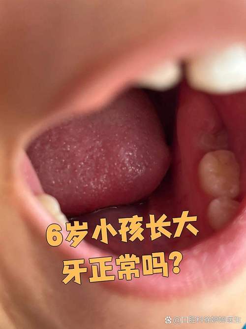最里面大牙边长了个牙齿