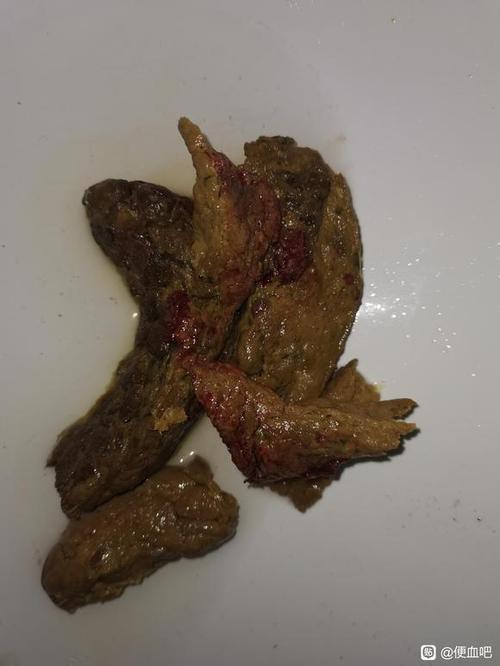 血与大便混合图片