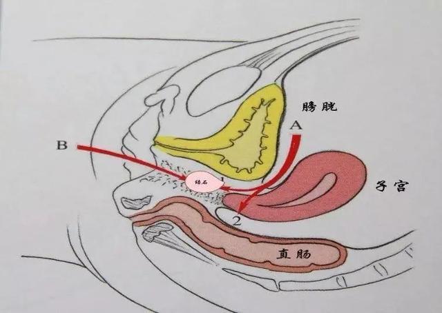 石女能治好吗还能生孩子吗缩略图